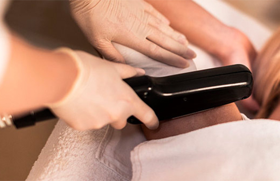 Is laser hair removal permanent?